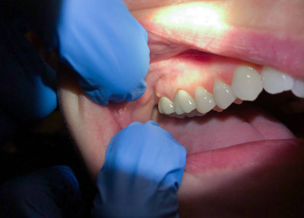 Best Cosmetic Emergency Dentistry in La Puente, CA